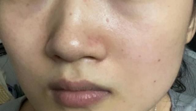 月经期腰疼可以艾灸腰部吗