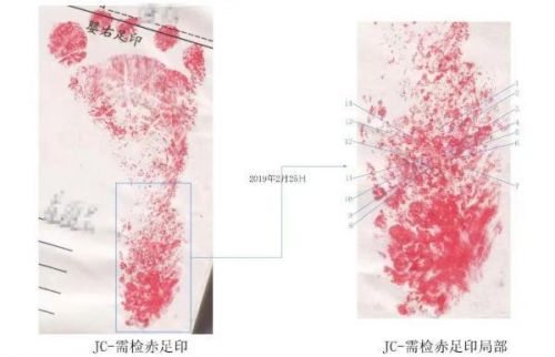 法医学鉴定图谱电子版(勒死的法医学鉴定)-第2张图片-