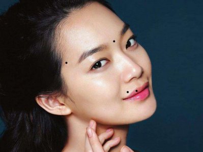 ​女人颧骨有痣好不好