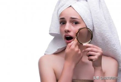 ​怎么去痘印最有效美白（如何有效淡化脸上的痘印？）