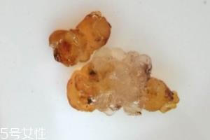 桃胶可以用开水泡吗？用开水泡桃胶好吗？